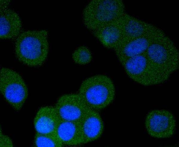 ICC staining phospho-PKA R2 (S99) in MCF-7 cells (green)