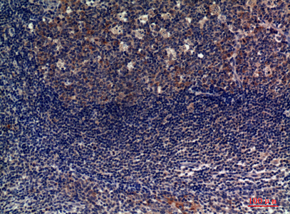Immunohistochemical analysis of paraffin-embedded human-tonsils, antibody was diluted at 1:100