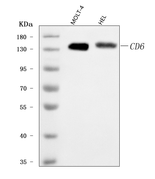  Western blot analysis of T12/CD6 using anti-T12/CD6 antibody (A03913-3)