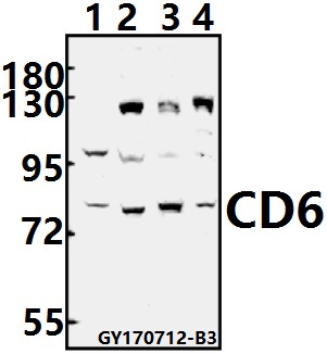 Western blot (WB) analysis of CD6 polyclonal antibody at 1:500 dilution
Lane1:Jurkat whole cell lysate(40ug)
Lane2:MCF-7 whole cell lysate(40ug)
Lane3:H9C2 whole cell lysate(40ug)
Lane4:AML-12 whole cell lysate(40ug)