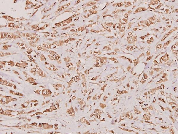 a03914 1 csta primary antiboties ihc testing 2