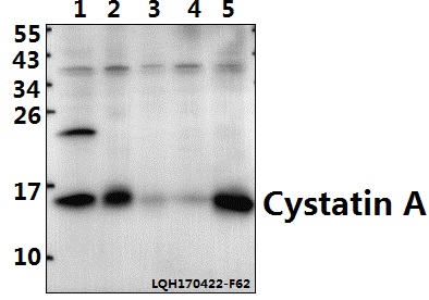 a03914 1 csta primary antiboties wb testing 1