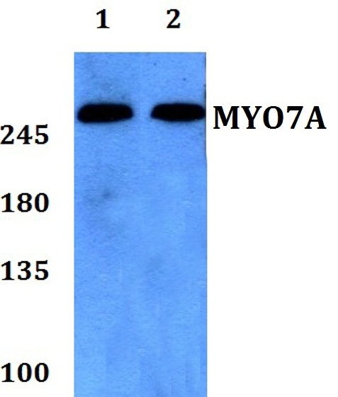 Western blot (WB) analysis of Myosin VIIa polyclonal antibody at 1:500 dilution
Lane1:SKOVCAR whole cell lysate
Lane2:HEK293T whole cell lysate