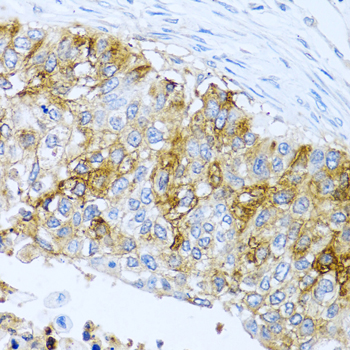 a03920 1 ifit3 primary antiboties ihc testing 2