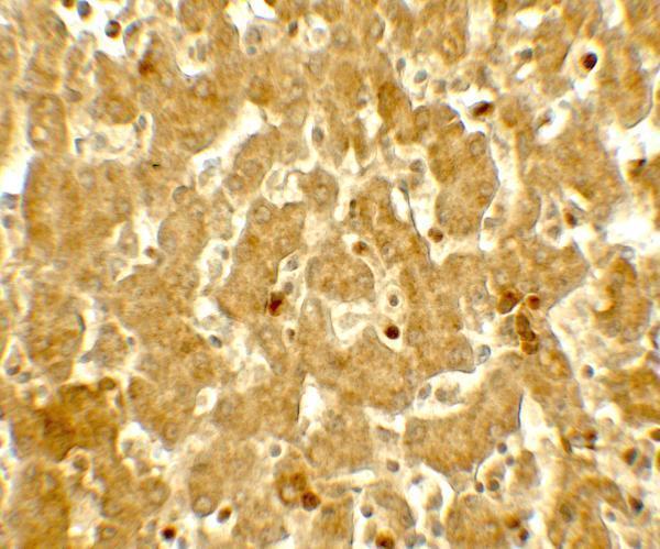 a03920 ifit3 primary antibodies ihc testing 2