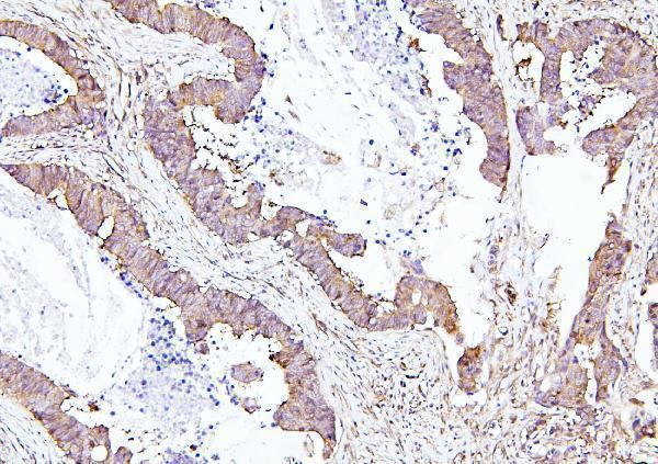 a03922 2 eif4a primary antibodies ihc testing 1