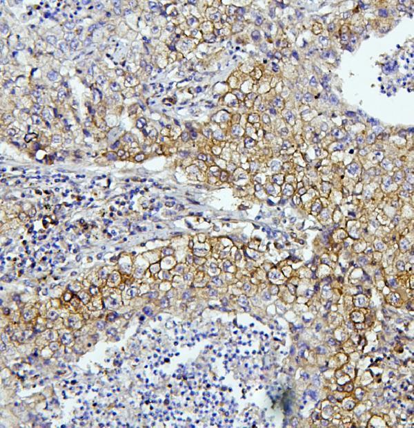 a03922 2 eif4a primary antibodies ihc testing 3