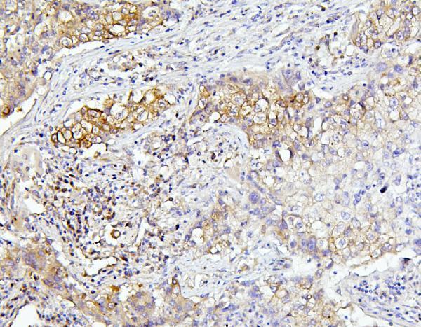 a03922 2 eif4a primary antibodies ihc testing 4