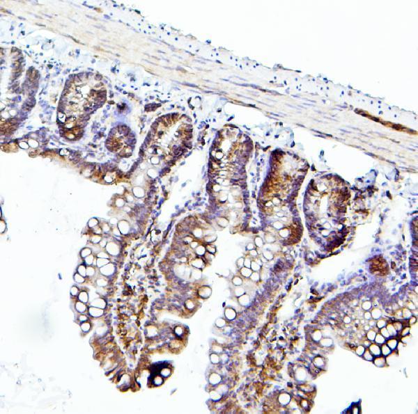 a03922 2 eif4a primary antibodies ihc testing 5