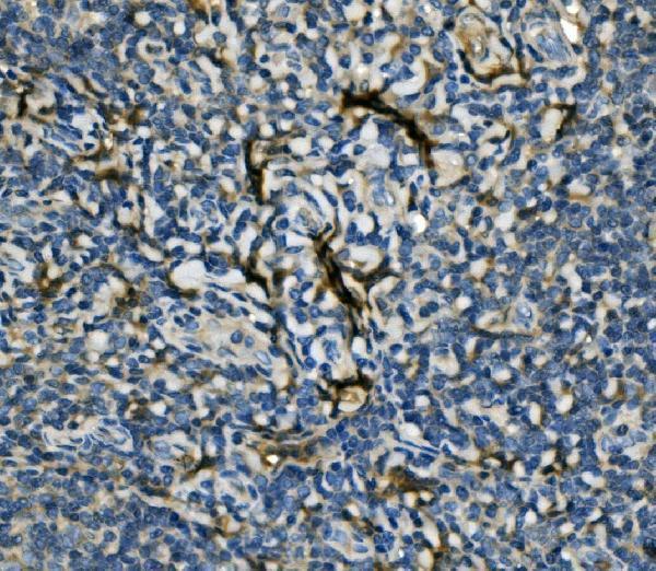 a03922 3 eif4a1 primary antibodies ihc testing 2