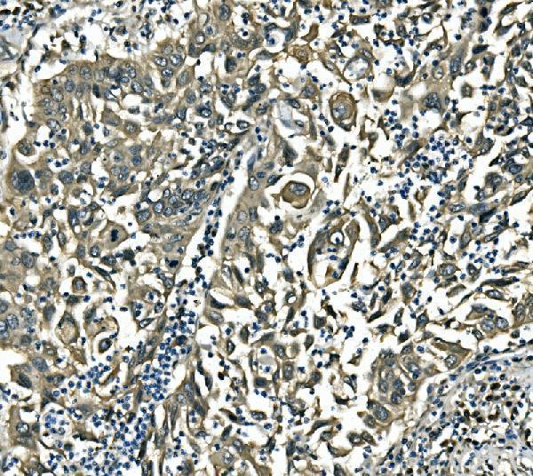 a03922 3 eif4a1 primary antibodies ihc testing 3