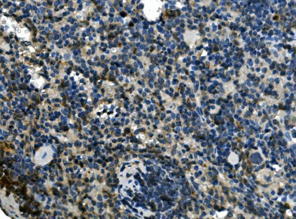 a03922 3 eif4a1 primary antibodies ihc testing 4