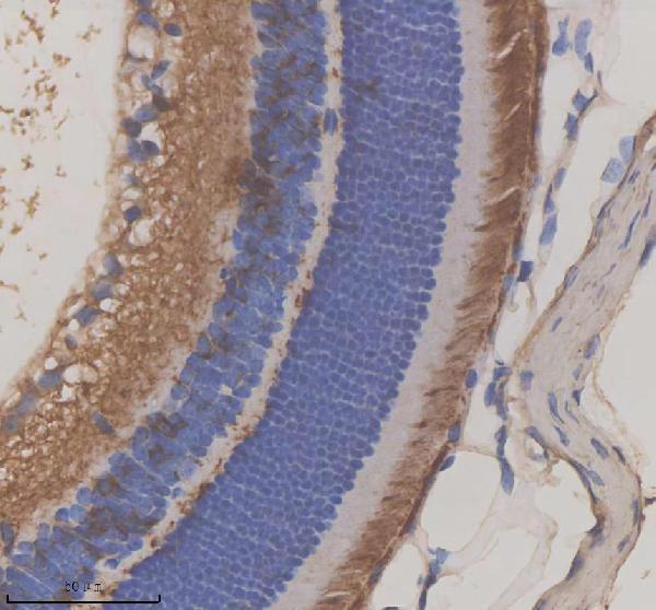 IHC analysis of GRK1 using anti-GRK1 antibody (A03924-2)