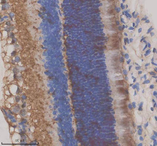 IHC analysis of GRK1 using anti-GRK1 antibody (A03924-2)