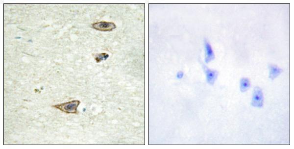 a03924 grk1 primary antibodies ihc testing 1