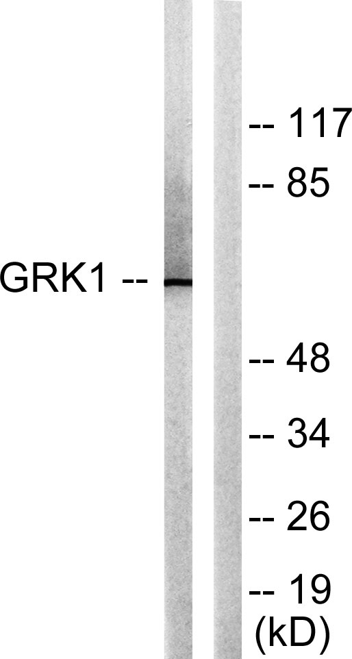a03924 grk1 primary antibodies wb testing 3