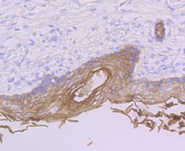 a03926 1 perp primary antiboties ihc testing 2