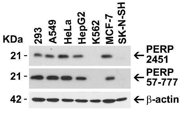 a03926 perp primary antibodies wb testing 1