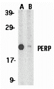 a03926 perp primary antibodies wb testing 3