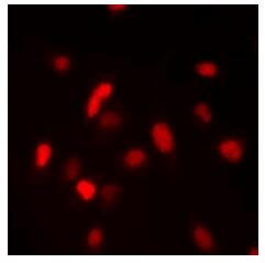 a03931 fancm primary antiboties if testing 2