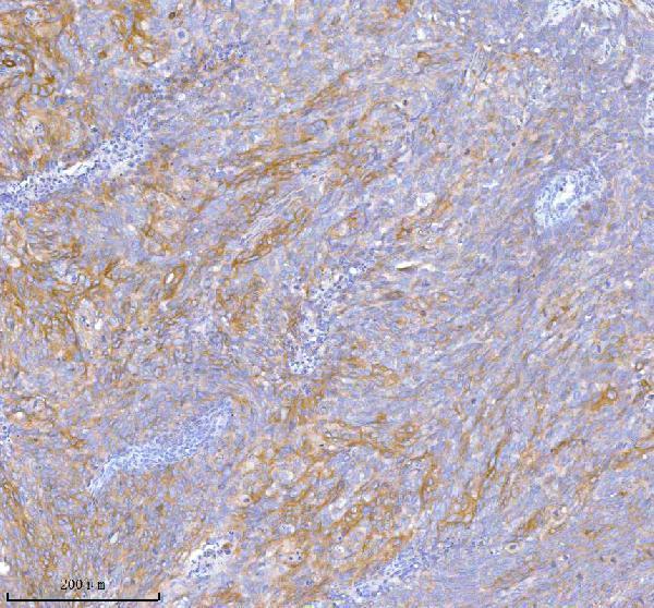  IHC analysis of TNIK using anti-TNIK antibody (A03934-3)