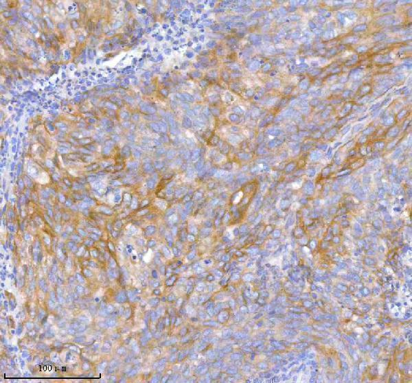  IHC analysis of TNIK using anti-TNIK antibody (A03934-3)