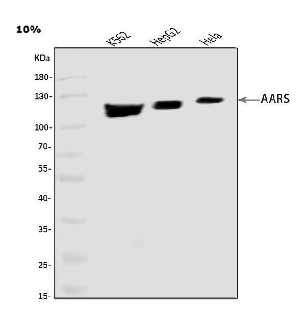  Western blot analysis of AlaRS/AARS1 using anti-AlaRS/AARS1 antibody (A03935-1)