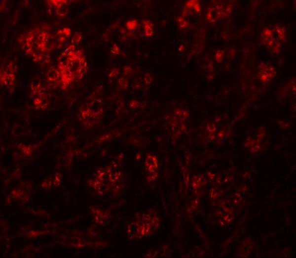 a03937 rabgef1 primary antibodies if testing 3