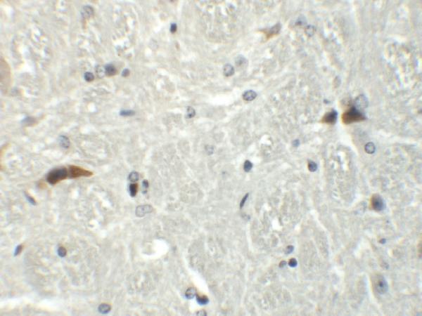 a03937 rabgef1 primary antibodies ihc testing 2