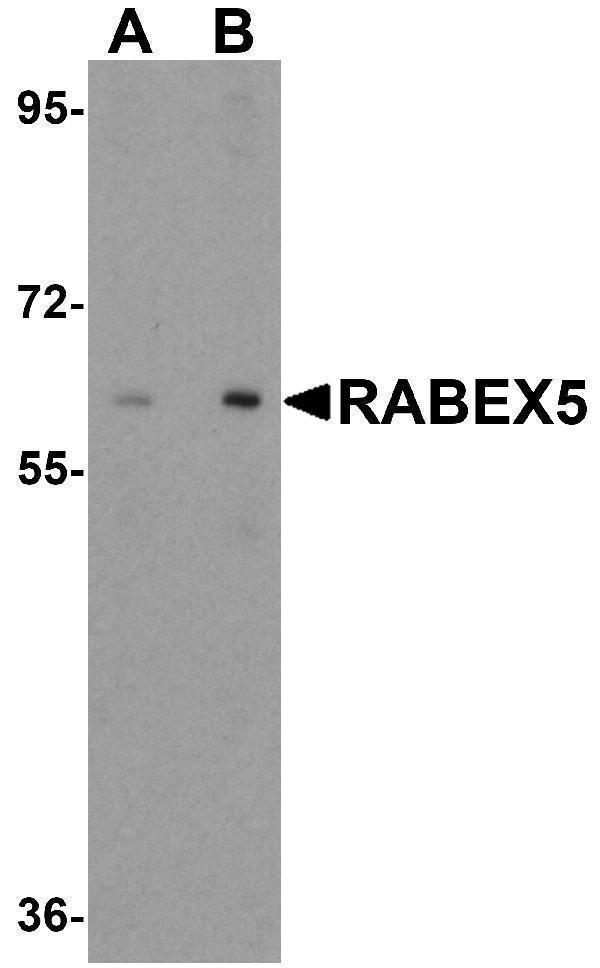 a03937 rabgef1 primary antibodies wb testing 1