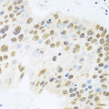 a03938 zbtb17 primary antiboties ihc testing 2