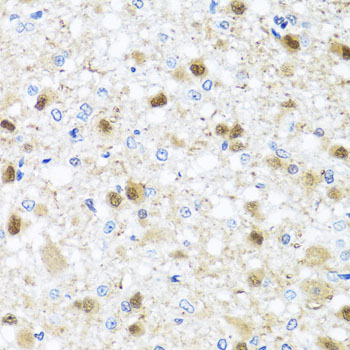 a03938 zbtb17 primary antiboties ihc testing 3