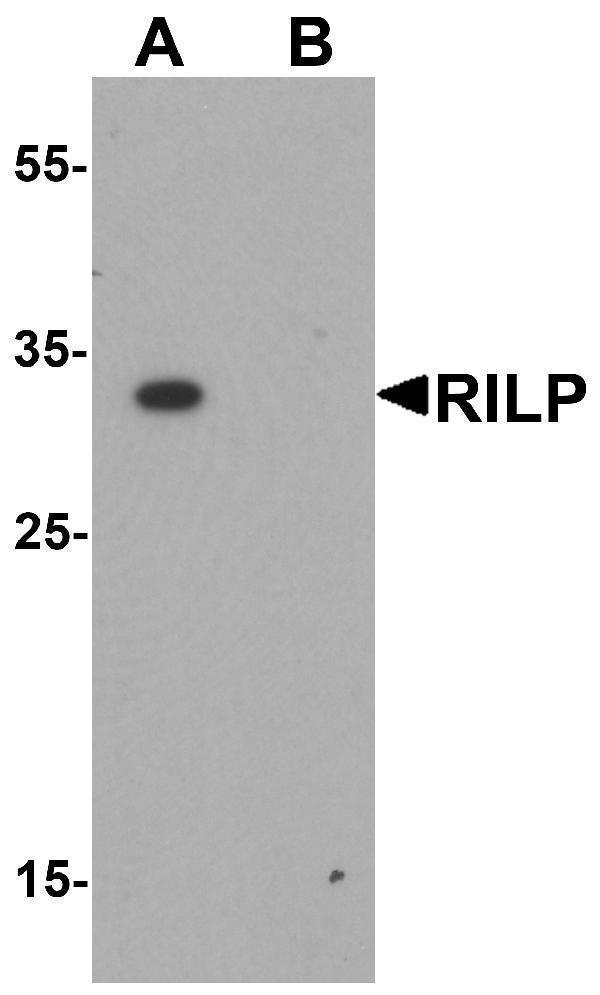 a03940 rilp primary antibodies wb testing 1