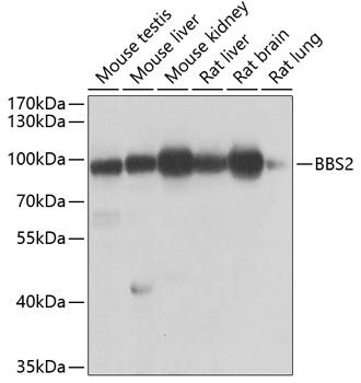 Western blot analysis of extracts of various cell lines, using BBS2 antibody  at 1:1000 dilution