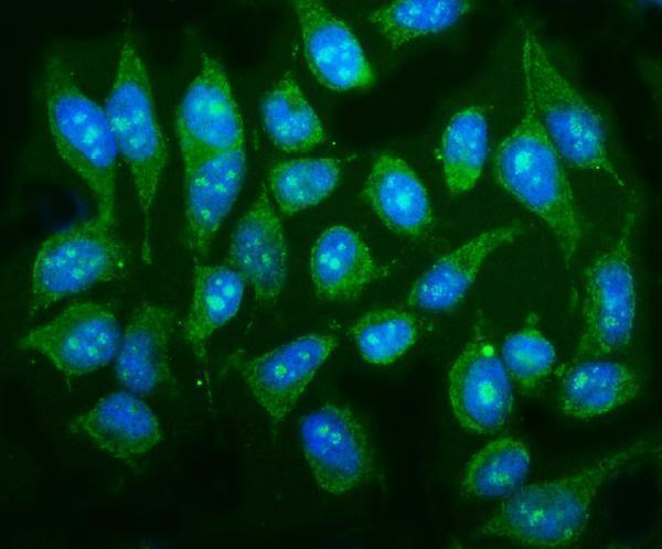 a03942 1 mapk12 primary antibodies if testing 2