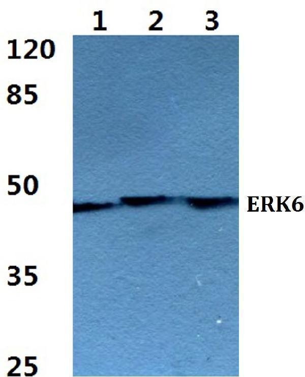 Western blot (WB) analysis of ERK6 polyclonal antibody at 1:500 dilution
Lane1:MCF-7 cell lysate
Lane2:NIH-3T3 cell lysate
Lane3:H9C2 cell lysate