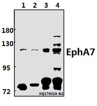 Western blot (WB) analysis of EphA7 (E477) pAb at 1:500 dilution
Lane1:3T3-L1 whole cell lysate(40ug)
Lane2:H9C2 whole cell lysate(40ug)
Lane3:A549 whole cell lysate(40ug)
Lane4:HEK293T whole cell lysate(40ug)