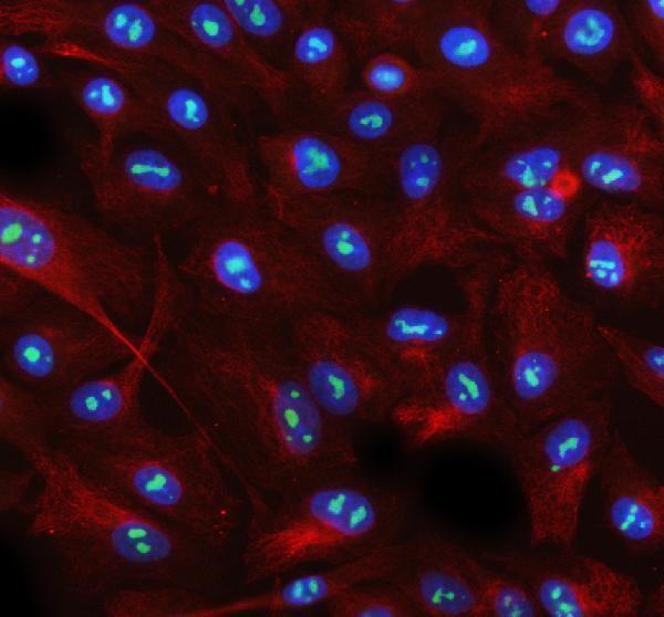 a03945 3 aatf primary antibodies if testing 6