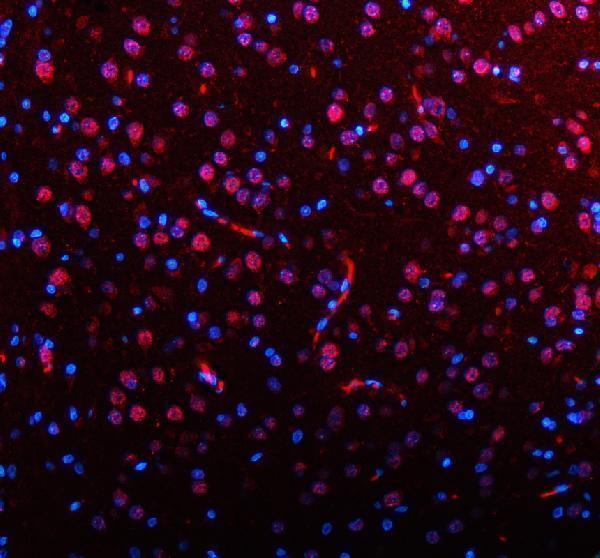 a03945 3 aatf primary antibodies if testing 7