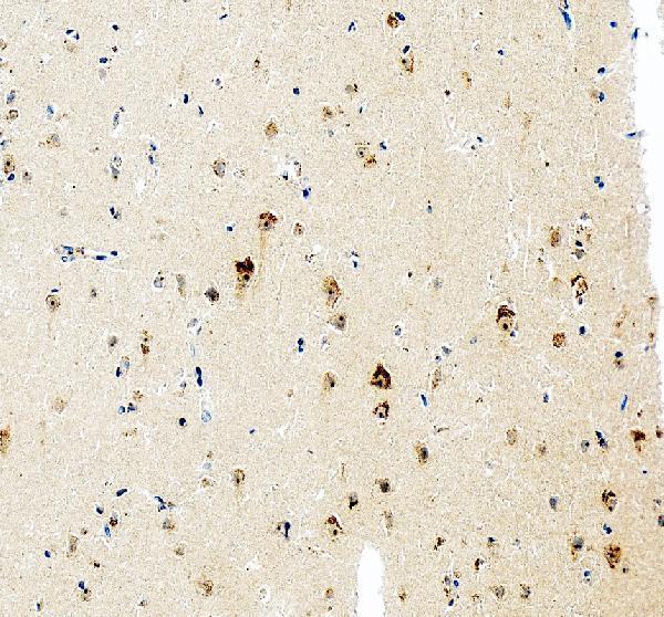 IHC analysis of AATF using anti-AATF antibody (A03945-3)