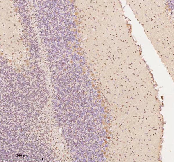 a03945 3 aatf primary antibodies ihc testing 2