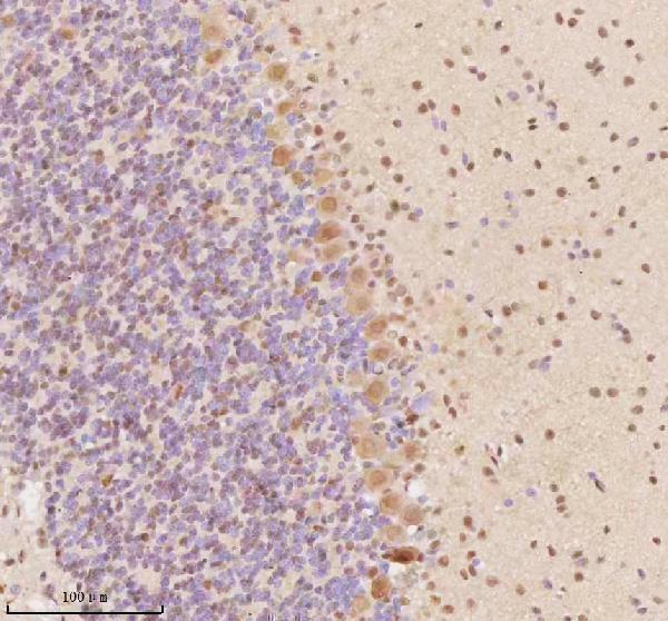 a03945 3 aatf primary antibodies ihc testing 3