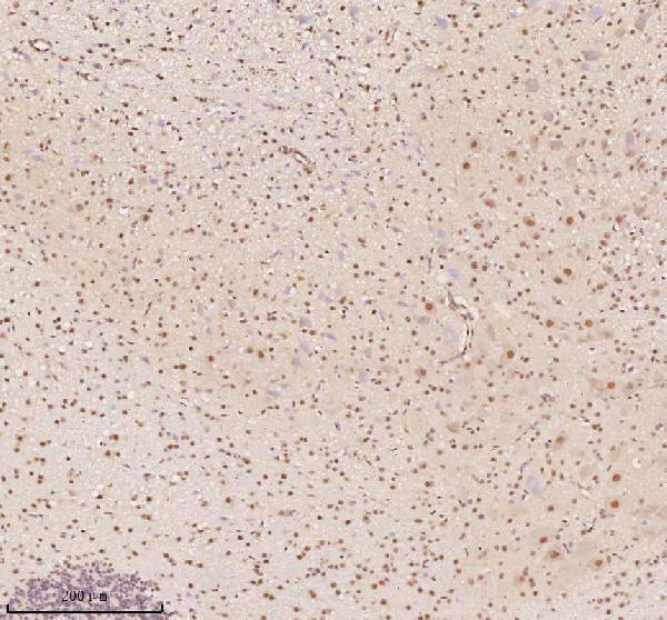 a03945 3 aatf primary antibodies ihc testing 4