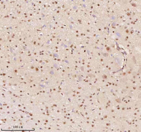 a03945 3 aatf primary antibodies ihc testing 5