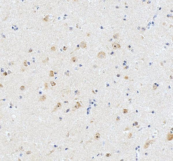 IHC analysis of AATF using anti-AATF antibody (A03945-3)