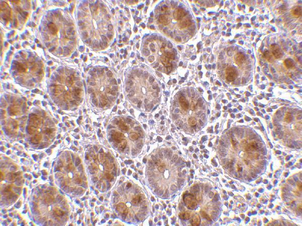 a03945 aatf primary antibodies ihc testing 2