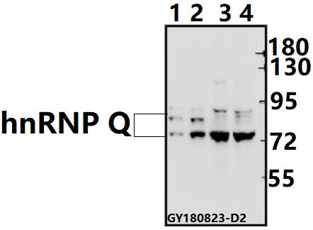 Western blot (WB) analysis of hnRNP Q (E268)  pAb at 1:500 dilution
Lane1:U-87MG whole cell lysate(10ug)
Lane2:HCT116 whole cell lysate(10ug)
Lane3:C6 whole cell lysate(40ug)
Lane4:CT26 whole cell lysate(40ug)