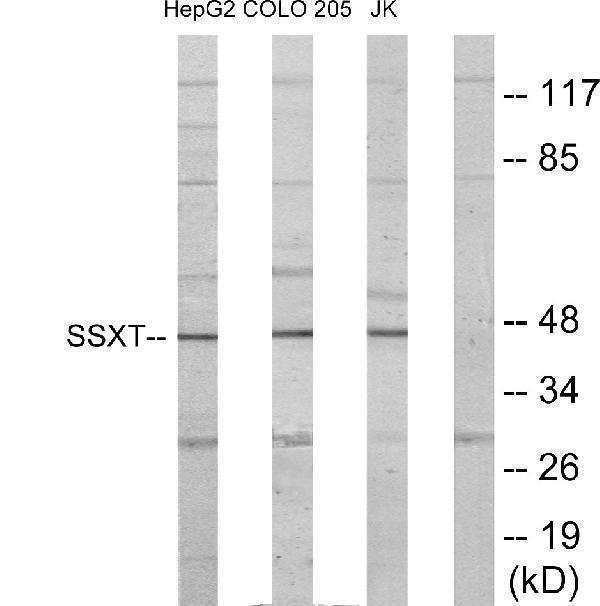 Western blot analysis of lysates from HepG2, Jurkat, and COLO205 cells, using SSXT Antibody