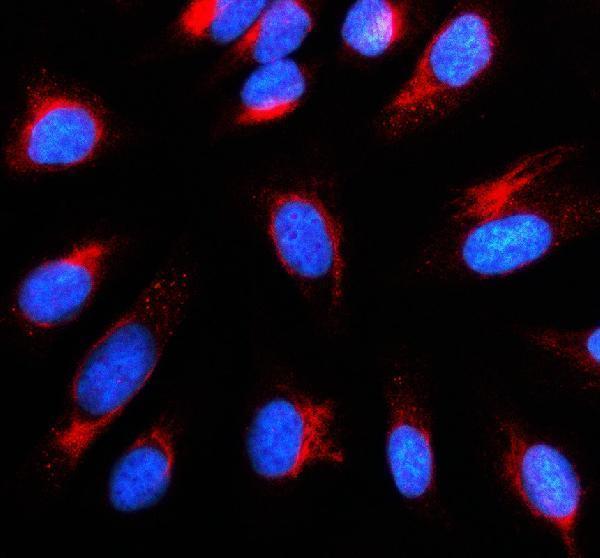 IF analysis of GSTZ1 using anti-GSTZ1 antibody (A03948-1)