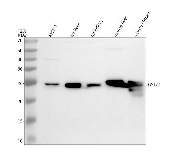 Western blot analysis of GSTZ1 using anti-GSTZ1 antibody (A03948-1)